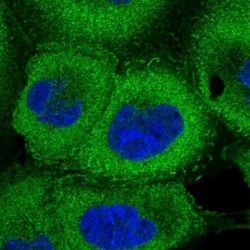 26S proteasome subunit 9 Antibody, Novus Biologicals 0.1mL; Unlabeled:Antibodies,